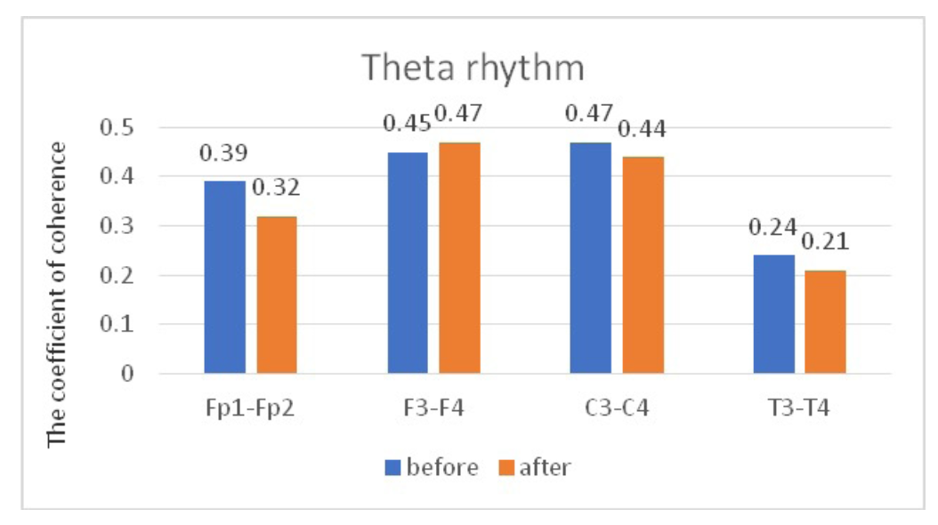 Fig. 6. Main characteristics of IC in JME patients in the theta band: blue column – before WT; orange column – after WT.